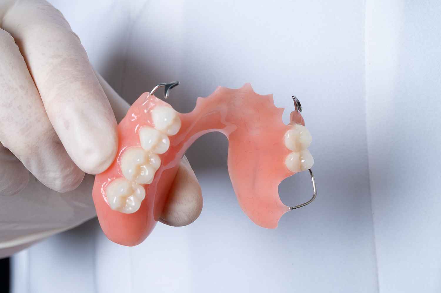 Five Things You Will Feel After Getting Your Partial Dentures